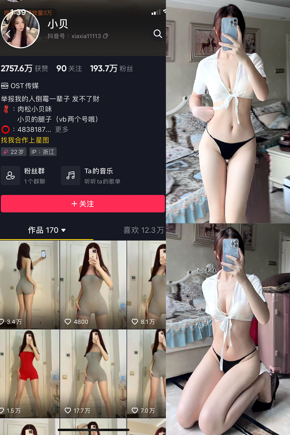 抖音 小贝 VIP 微密圈 NO.005期 【28P】-萤火集