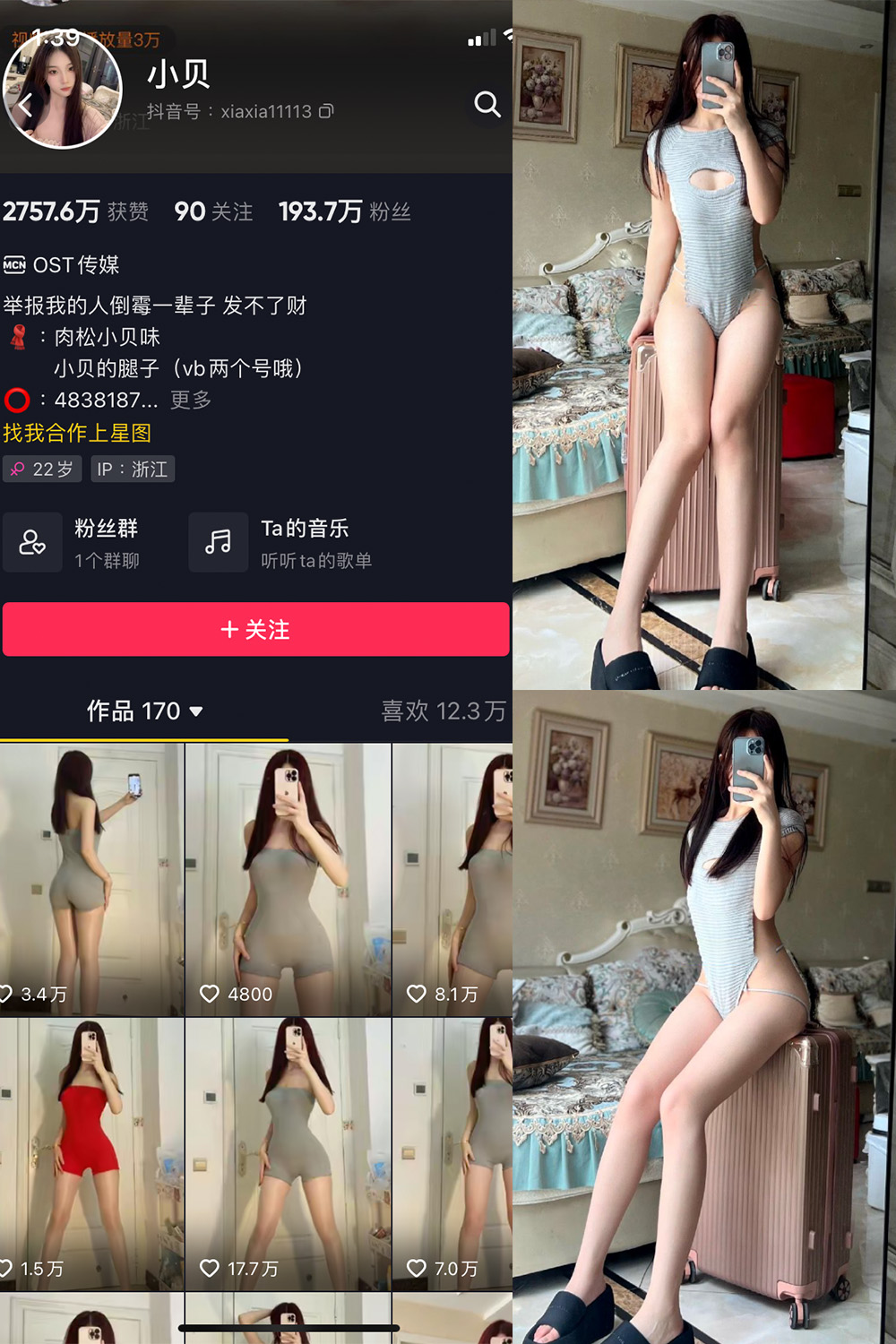 抖音 小贝 VIP 微密圈 NO.007期 【28P】-萤火集