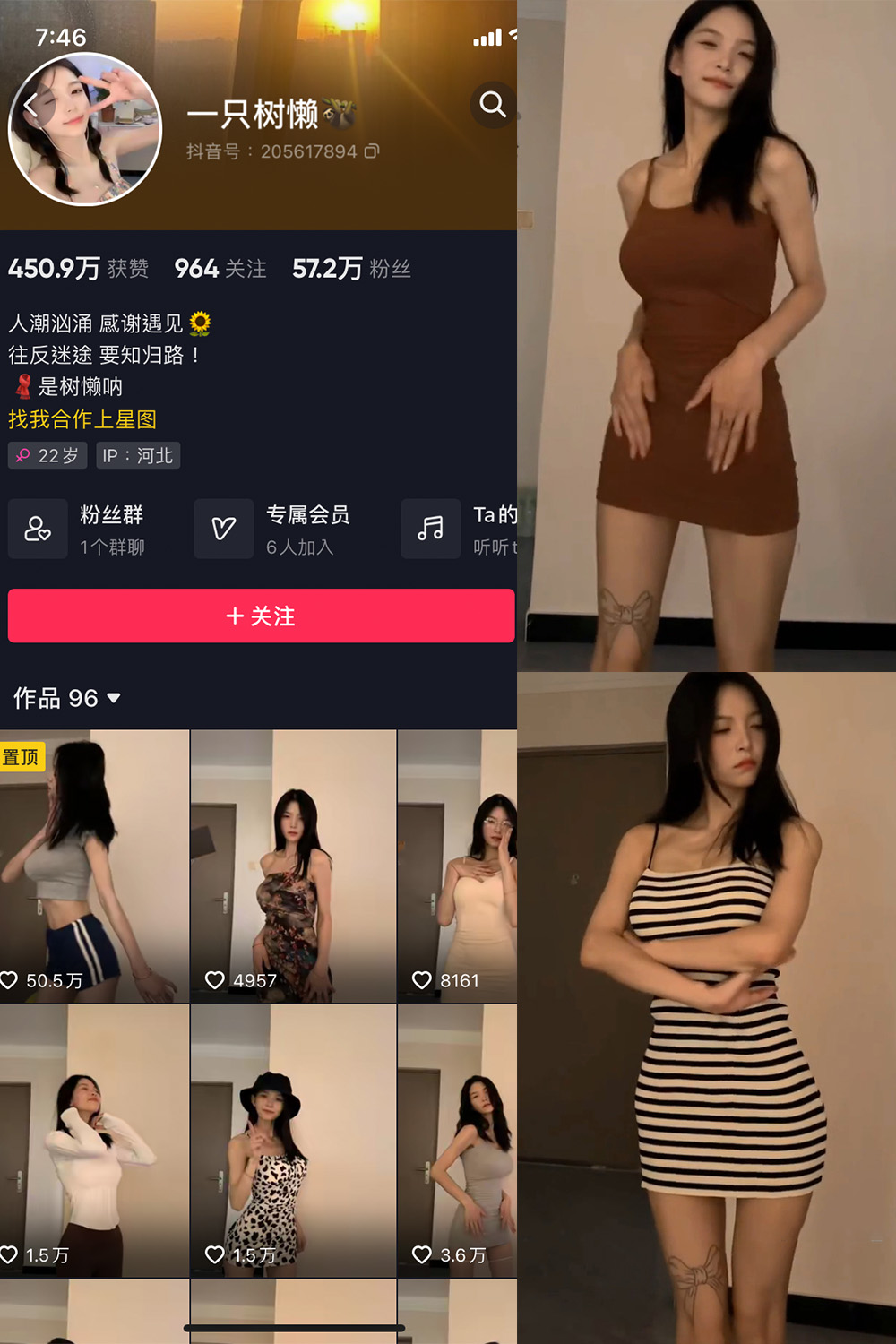 抖音 一只树懒 微密圈  NO.004期 【21P10V】-萤火集