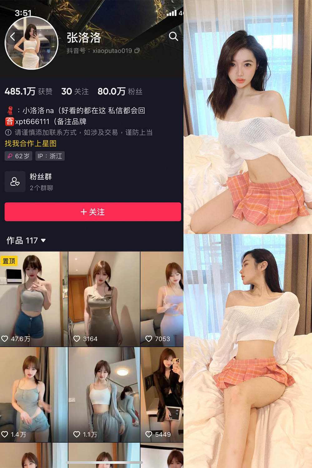 抖音 张洛洛 微密圈 NO.001期 【30P】-萤火集